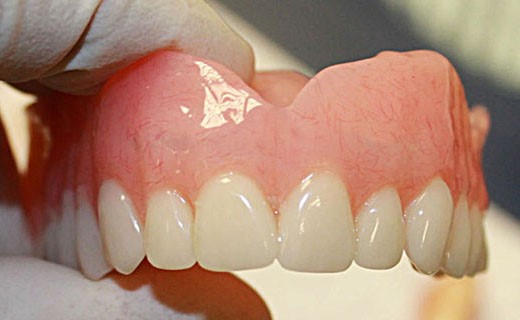 Pink Acid Queen Dentures Post OR 97752